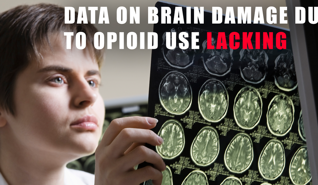 Data on brain damage due to opioid use lacking