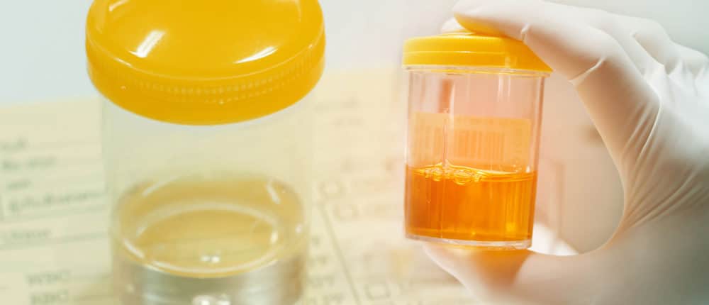 Certified Specimen Collector